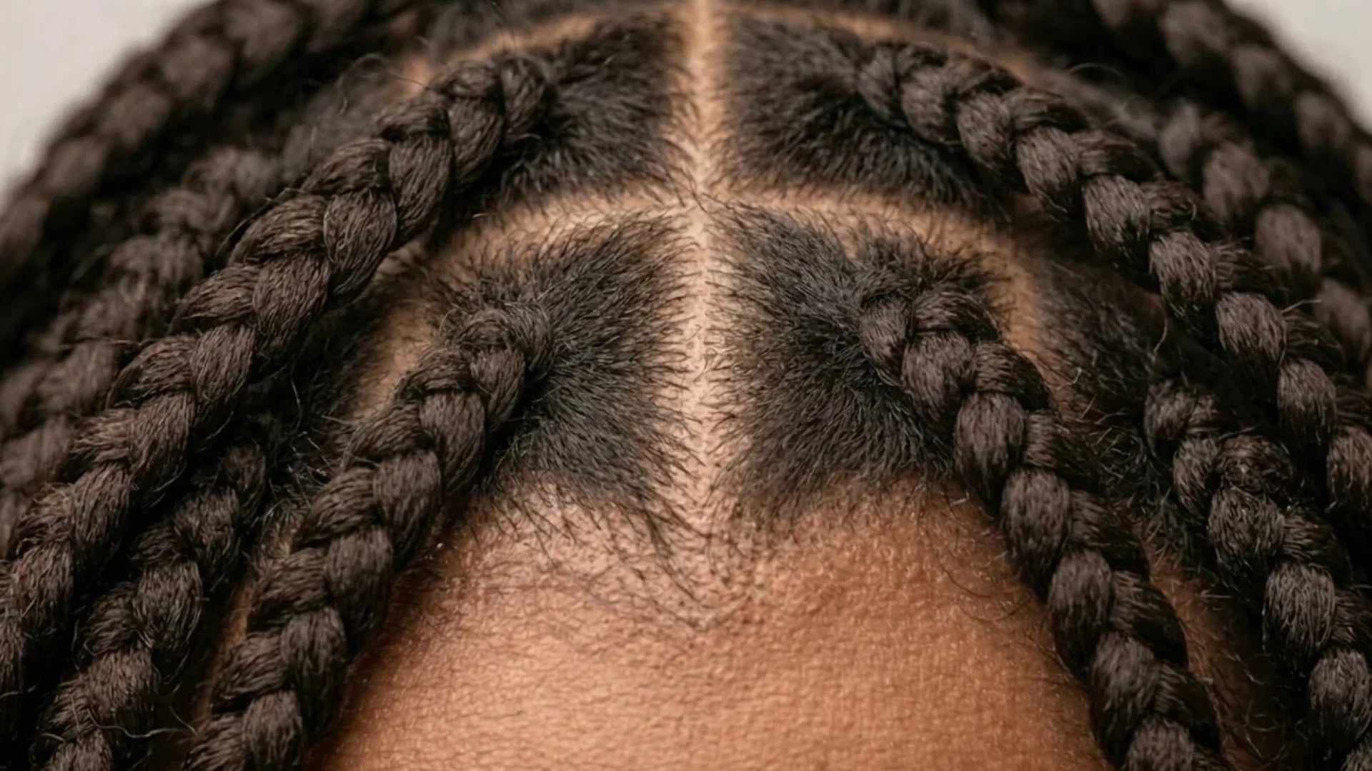 Close-up of braided hair with visible scalp showing dandruff flakes along the part line.