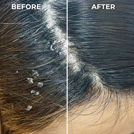 HoneyCalm Hair & Scalp Oil